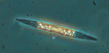 File:Nitzschia hungarica 2.jpg