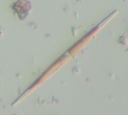 File:Nitzschia sp1.jpg