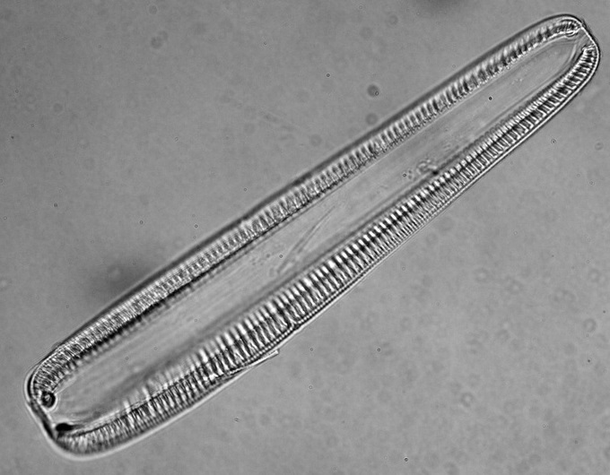 File:Rhopalodia vermicularis.jpg