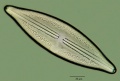 Anomoeoneis sphaerophora.jpg